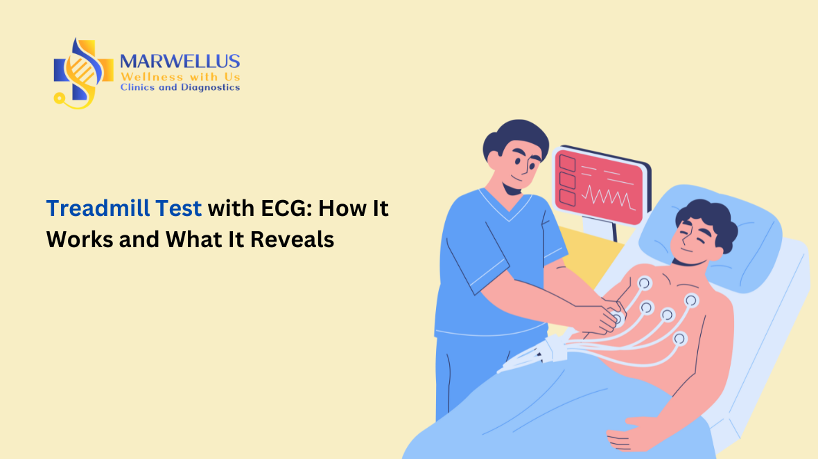 treadmill test with ECG