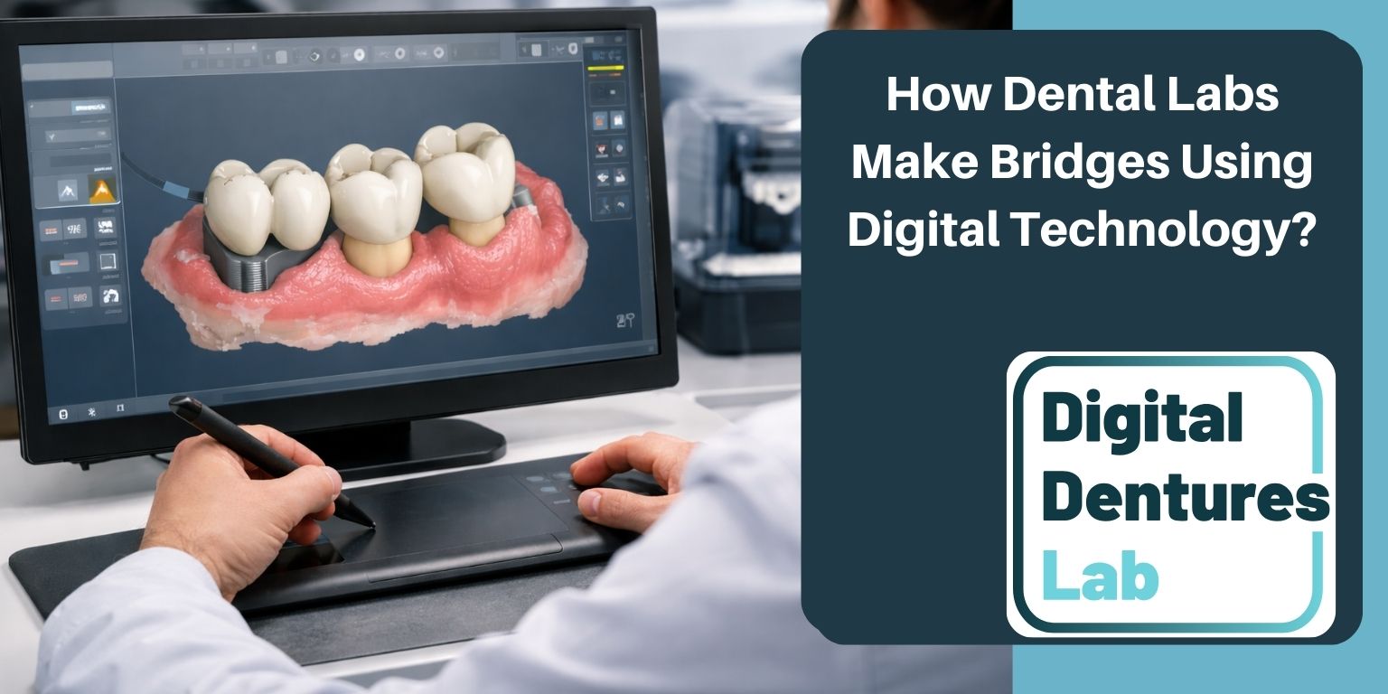 how dental labs make bridges