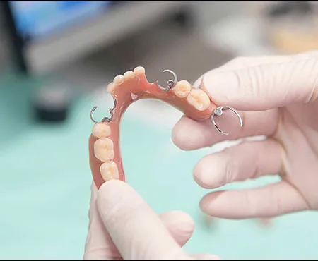Image of Partial Dentures