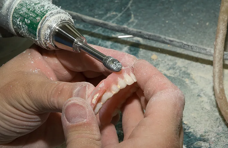 Professional Denture Repairs for Your Practice’s Needs