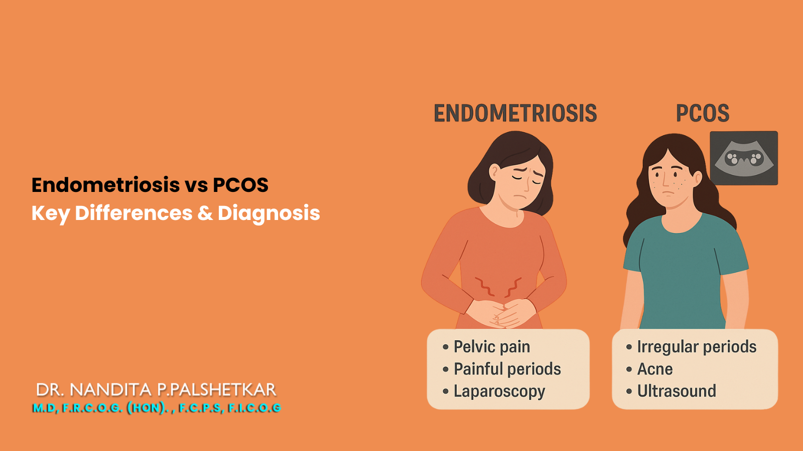 Infographic comparing symptoms of Endometriosis vs PCOS, highlighting symptoms like pelvic pain, painful periods for Endometriosis, and irregular periods, acne for PCOS