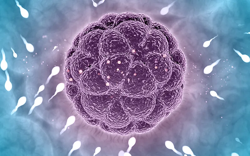 ICSI (Intracytoplasmic Sperm Injection)