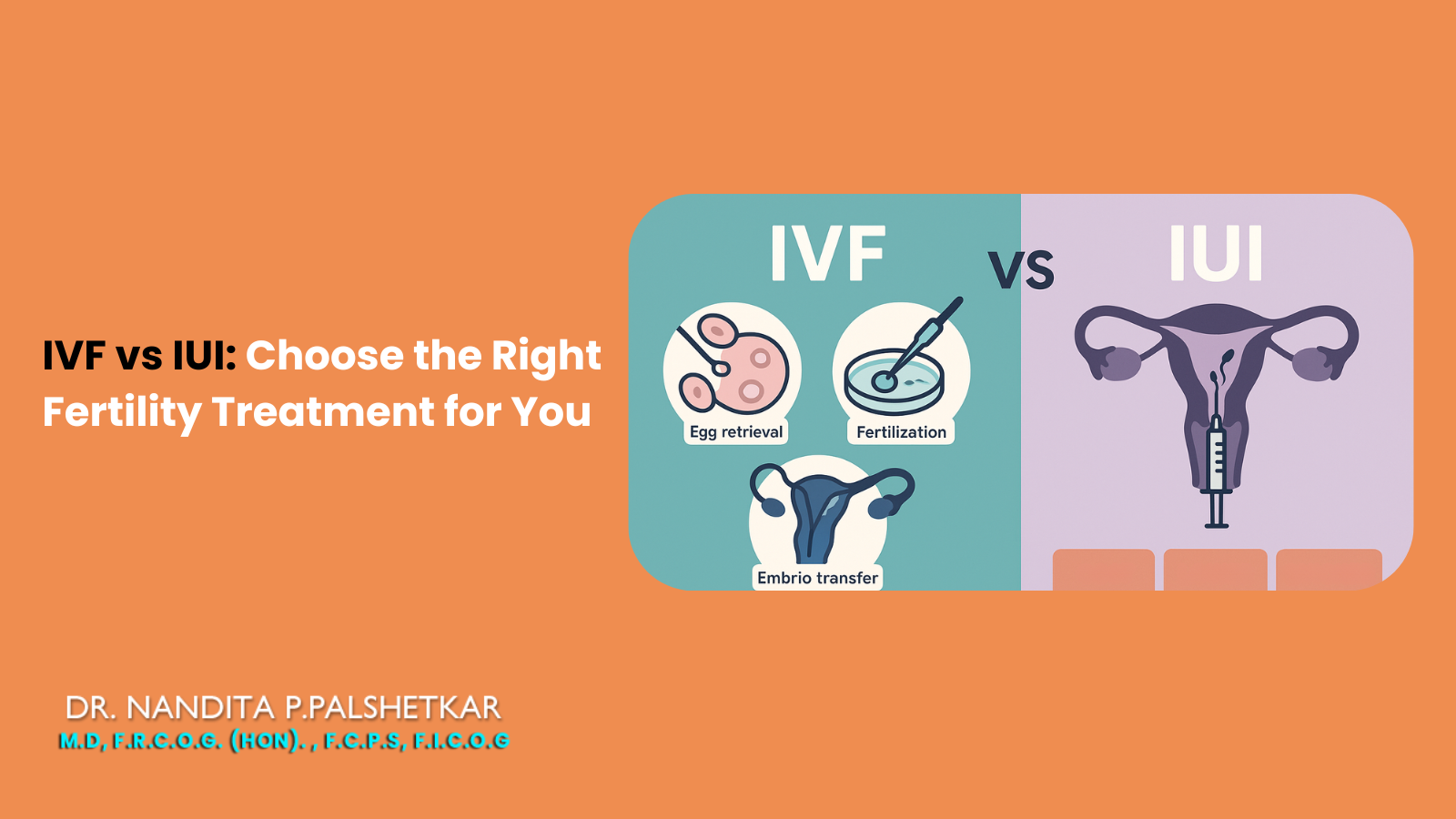Comparing IVF vs IUI fertility treatments, highlighting key differences in cost, success rates, and suitability.