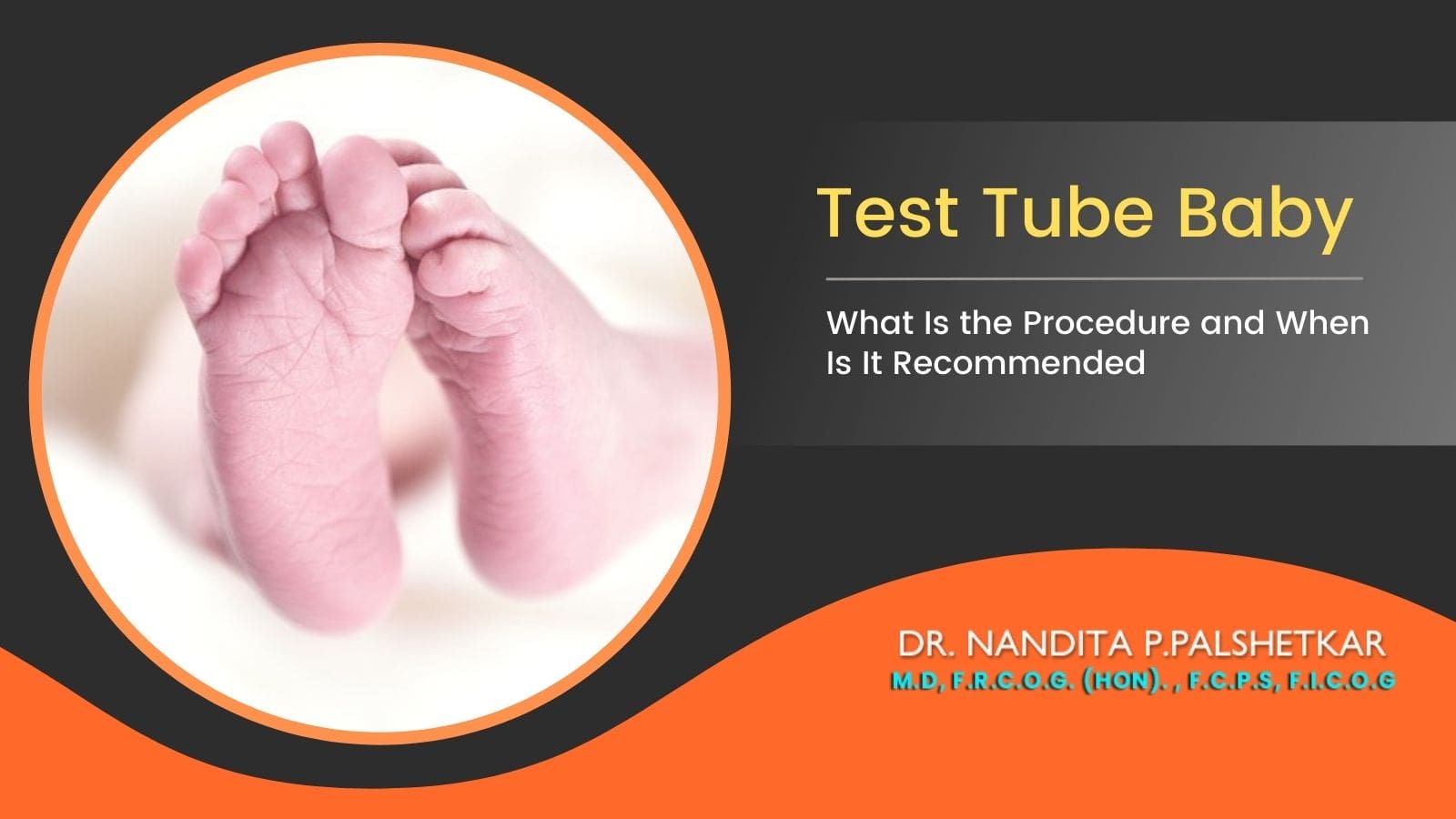 Test Tube Baby - What Is the Procedure and When Is It Recommended