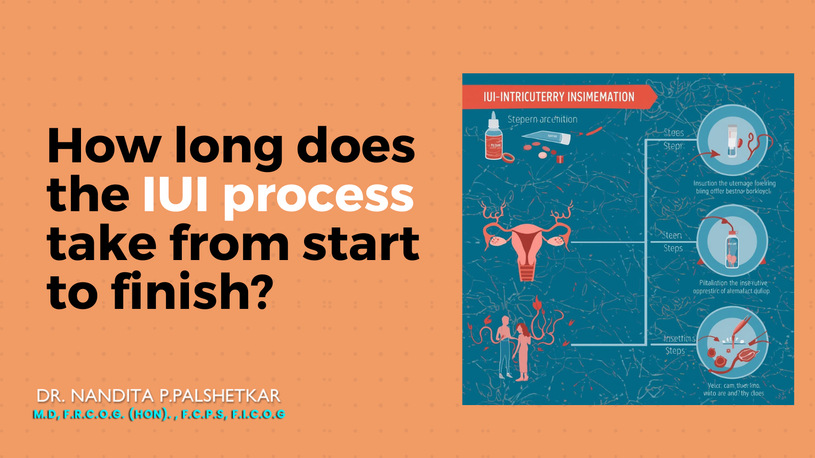 How long does the IUI process take from start to finish?