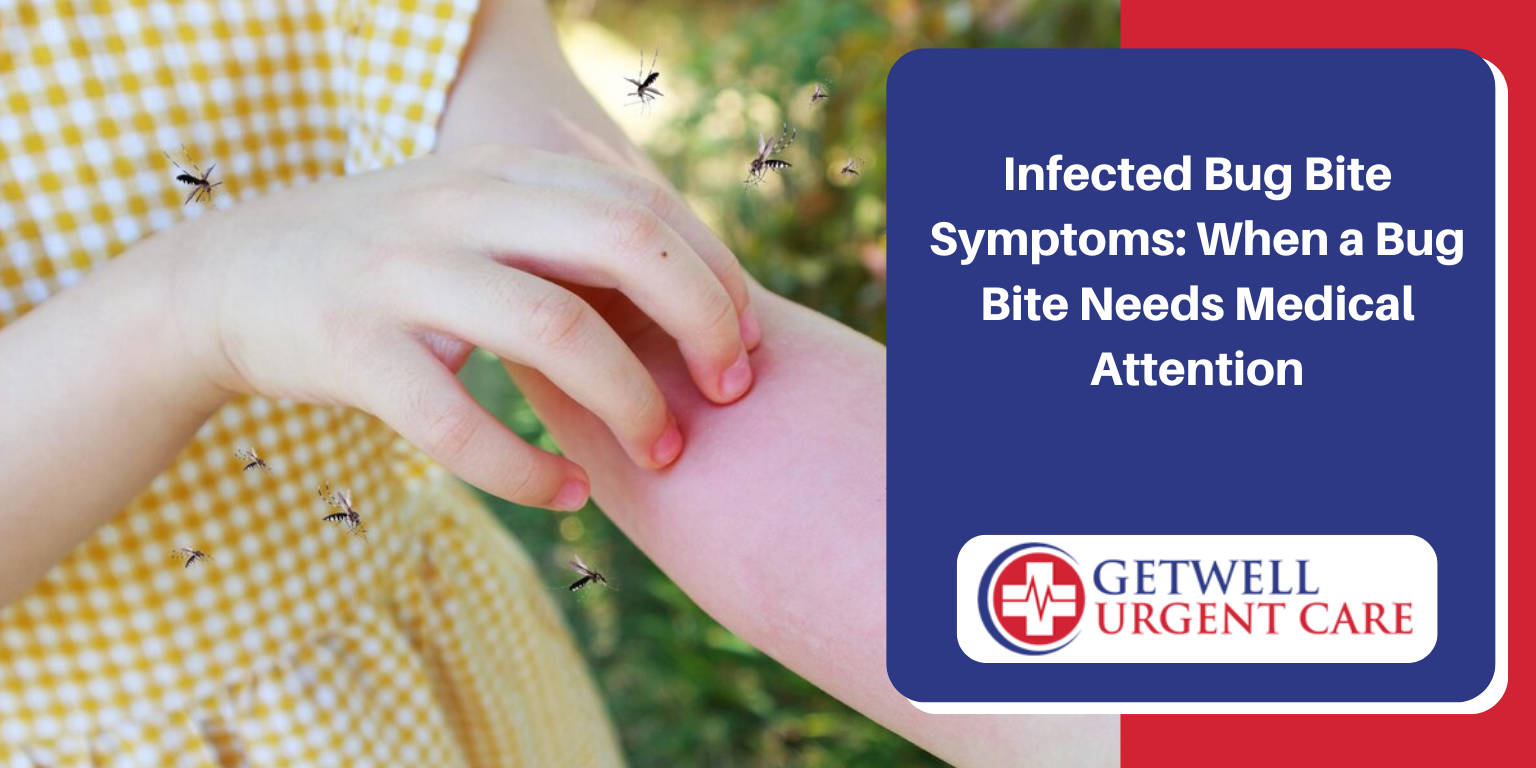 infected bug bite symptoms