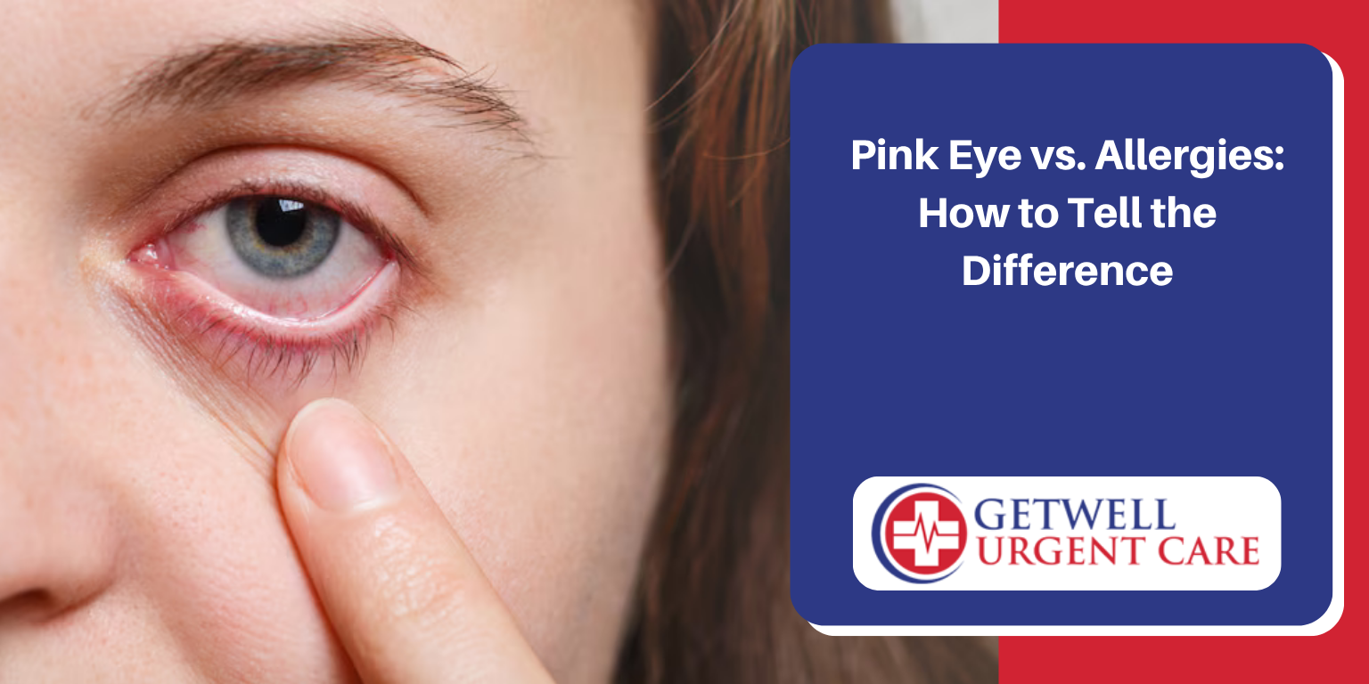 pink eye vs allergies