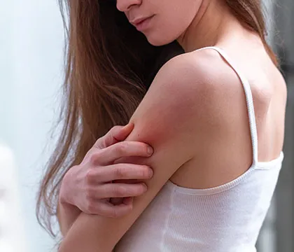 Skin infections and rash treatments