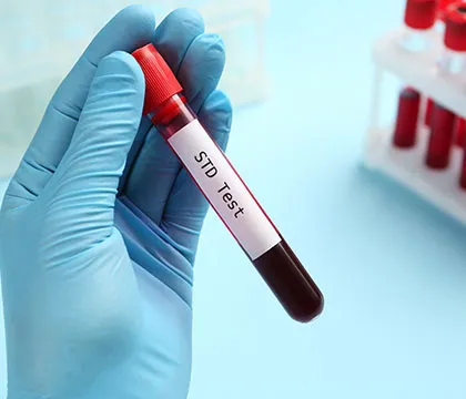 STD Testing