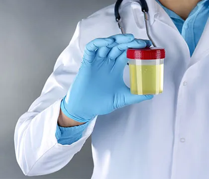 Urine Tests