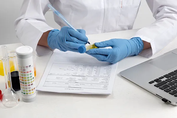 Effective UTI Testing & Care in Santa Clara, Merced & San Jose, CA