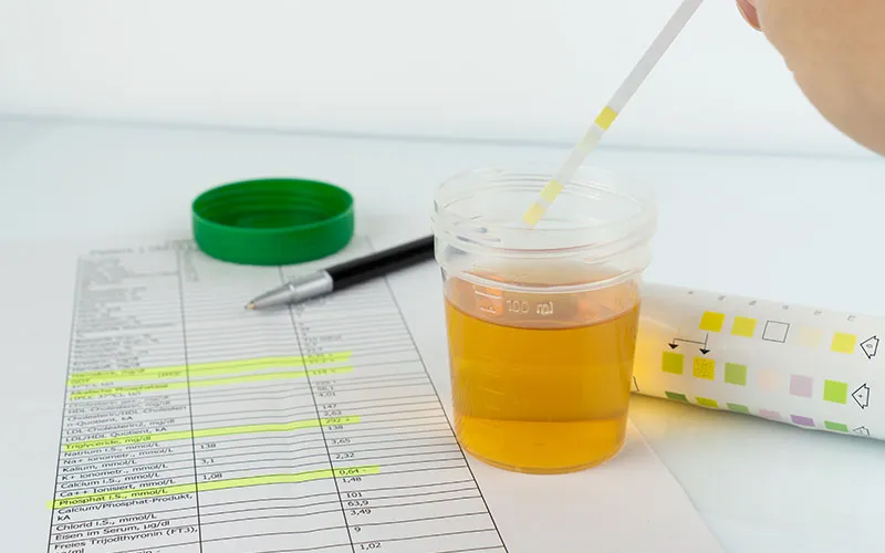 Understanding Urinary Tract Infections