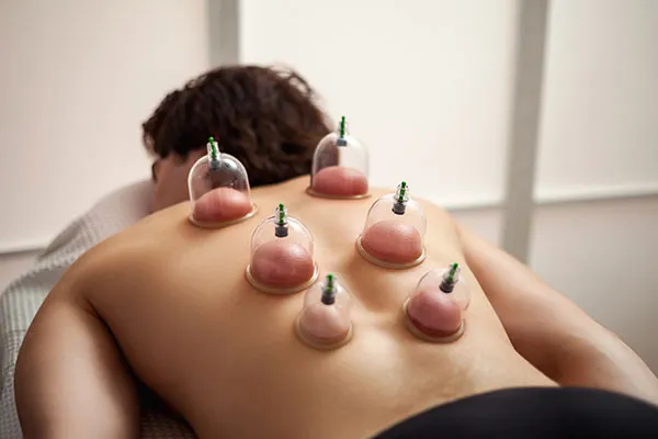 What Makes Cupping Therapy Unique?