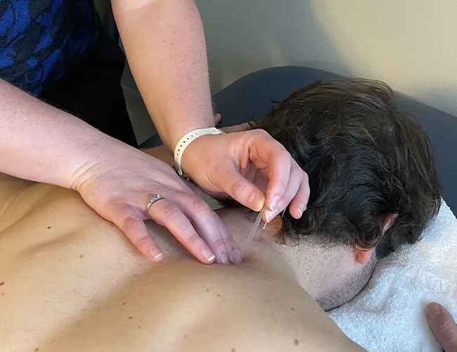 Why Choose Thrive Physical Therapy for Dry Needling?