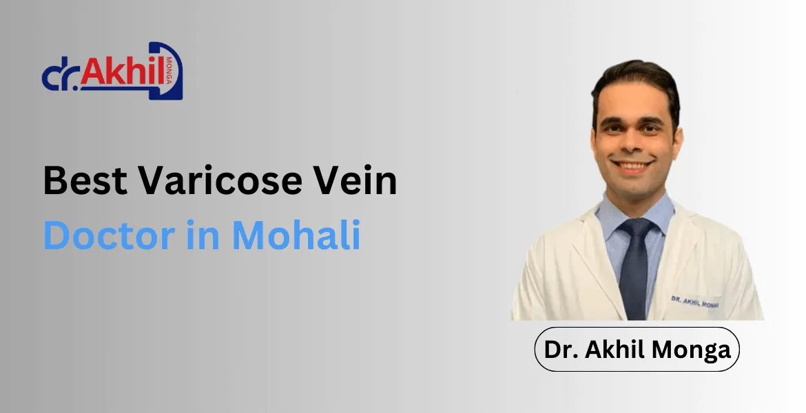  Best Varicose Vein Doctor in Mohali: Dr. Akhil Monga