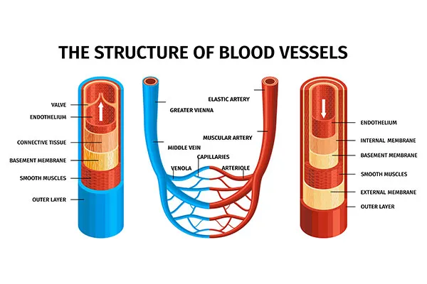 Benefits of Carotid Artery Stenting