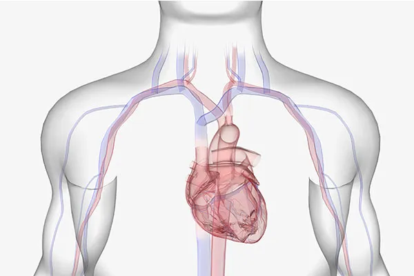 How is Central Vein Stenosis Treated?