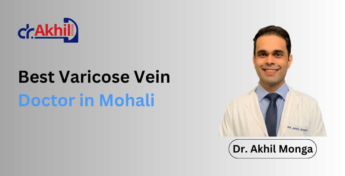 Best Varicose Vein Doctor in Mohali: Dr. Akhil Monga