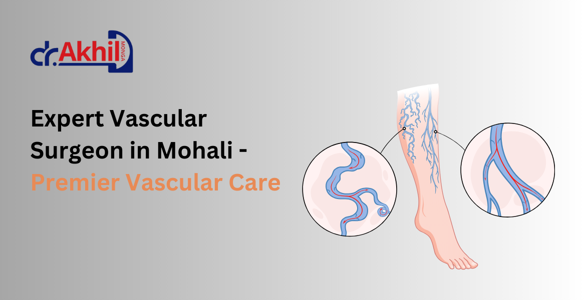 Vascular Surgeon Mohali: Expert Care for Vascular Health