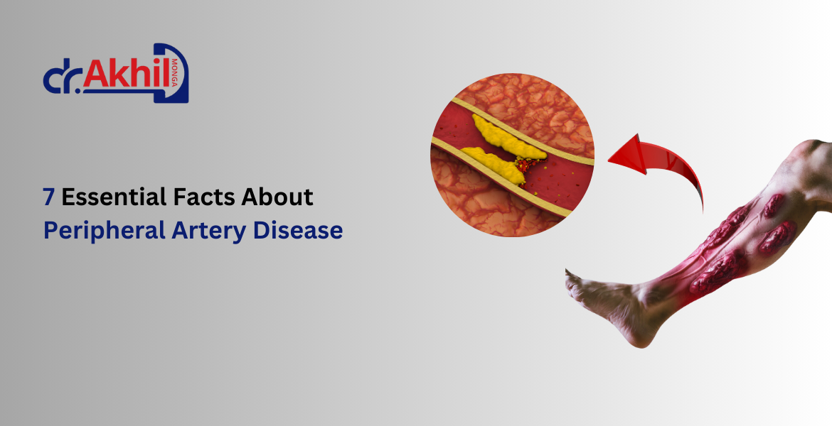 Graphic illustration showing common Peripheral Artery Disease (PAD) symptoms such as leg pain, numbness, and cold feet due to poor blood circulation.