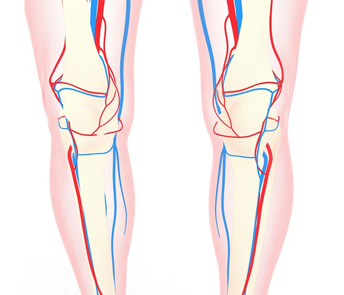 How Does Geniculate Artery Embolisation Work?