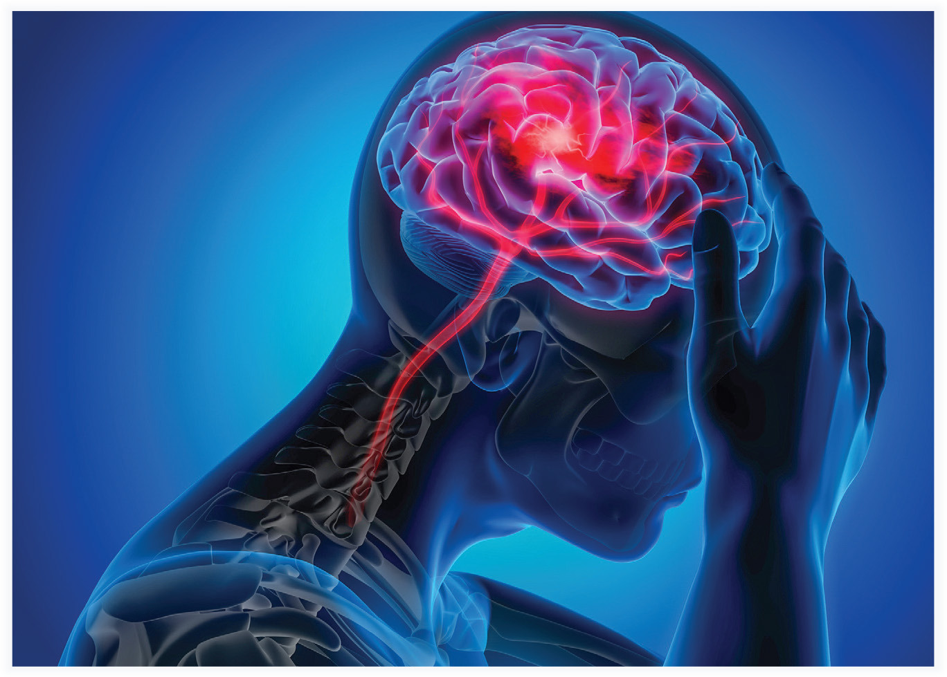 Endovascular Treatment For Acute Ischemic Stroke