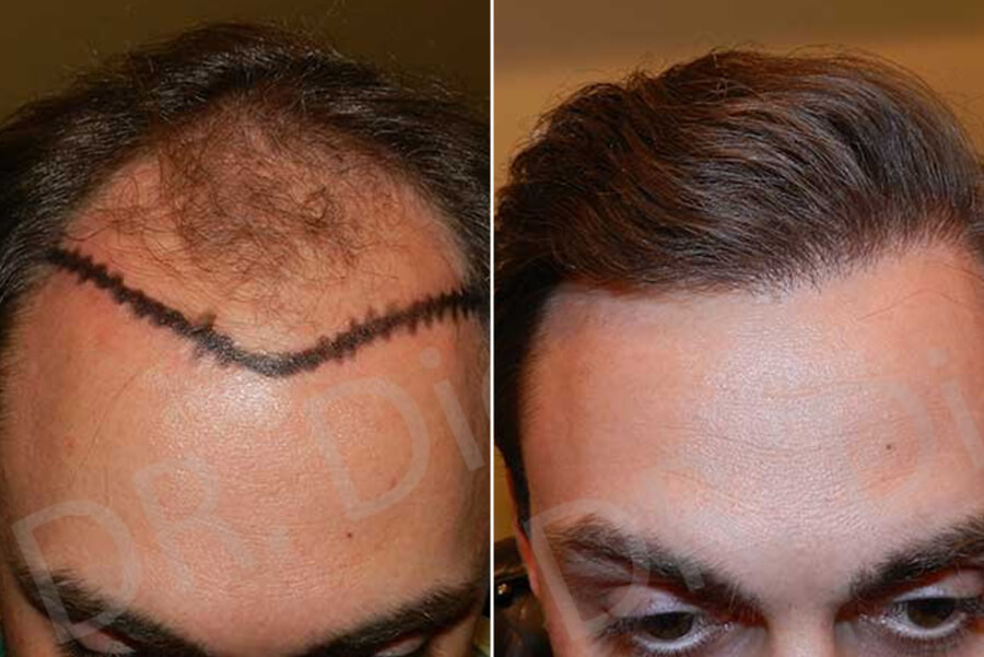 medical hair loss treatment