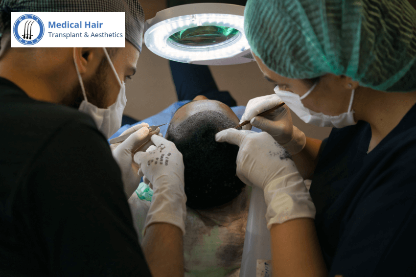 African American Hair Transplant Techniques