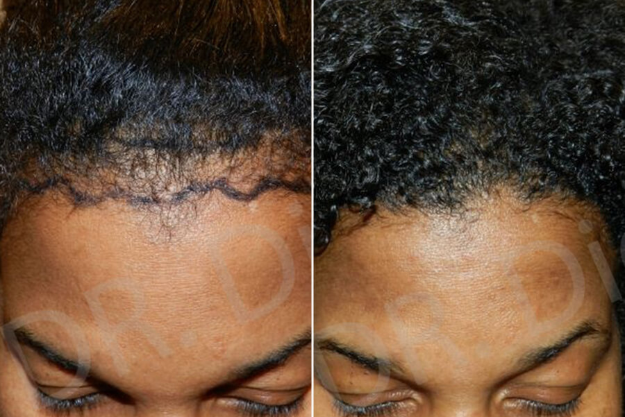 trichologist for african american hair near me