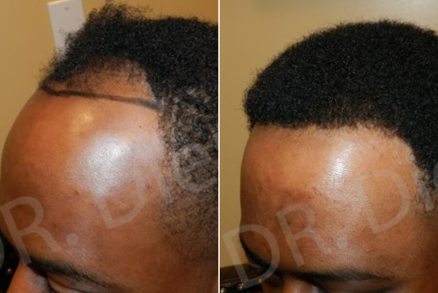 african american hair growth