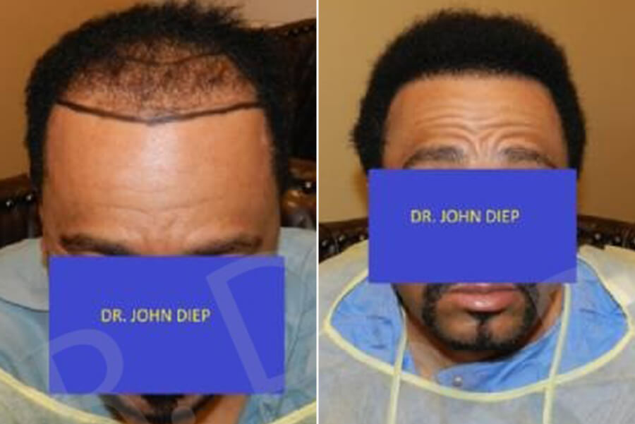 african hair growth treatment