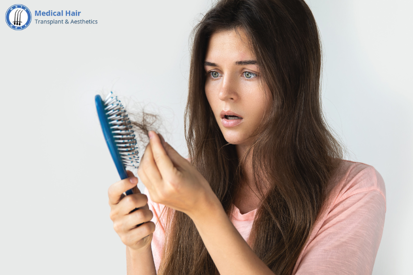 Causes of Hair Loss in Women: Diagnosis and Treatment Options