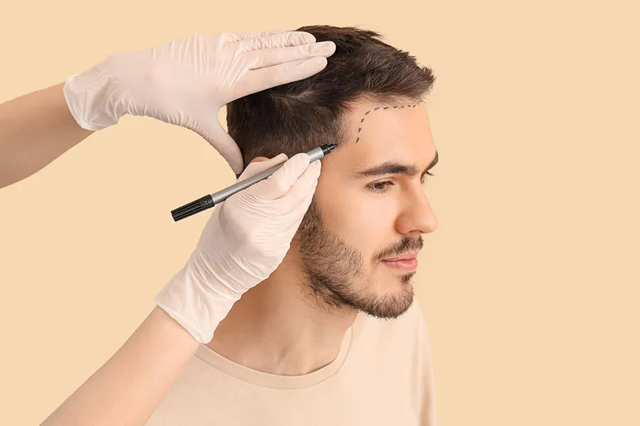 Achieve a Fuller, Younger You with Caucasian Hair Transplant in Oregon