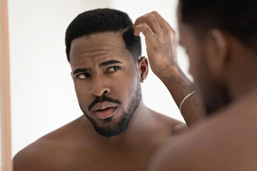 African American Hair Transplant Sacramento