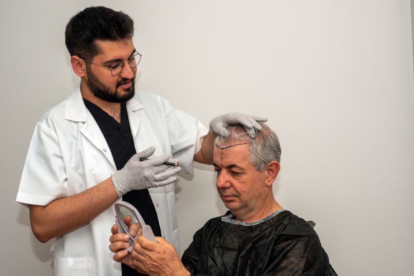 What is the cost of hair transplant?