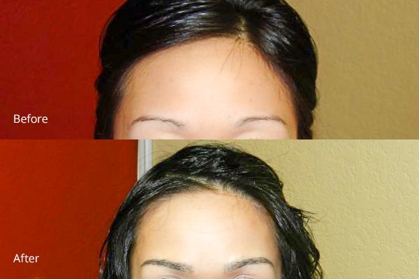 Before and After Bay Area Eyebrow Enhancements