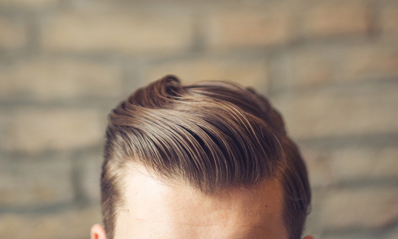 How to Style After Your Hair Transplant