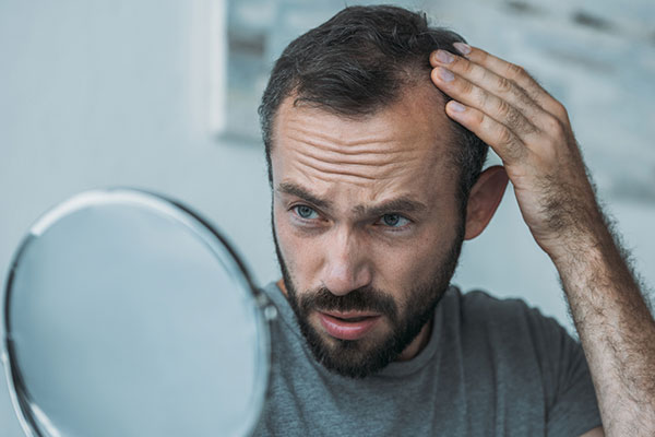 When Should You Consider Hair Transplant Services?