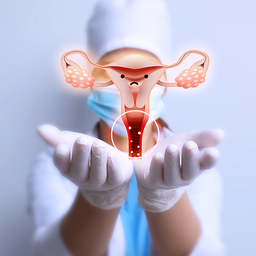 Adenomyomectomy