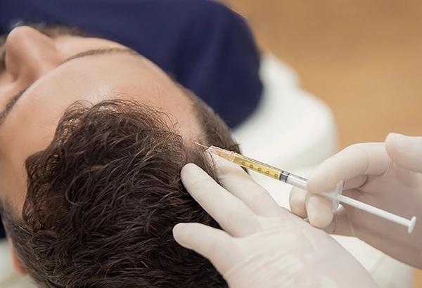 Hair Loss Treatments in Ahmedabad
