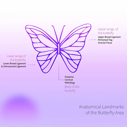 Butterfly Peritonectomy