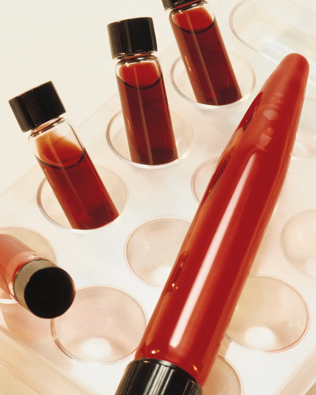 Blood processed in a centrifuge for PRP hair therapy