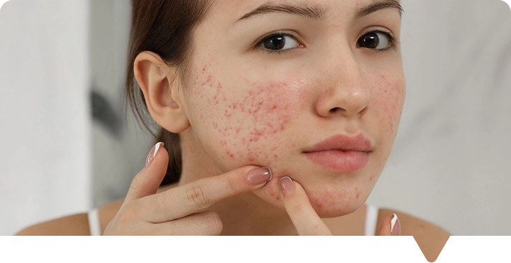 Dermatology