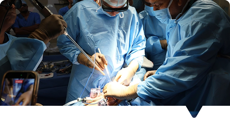 Gastro-intestinal Surgeries