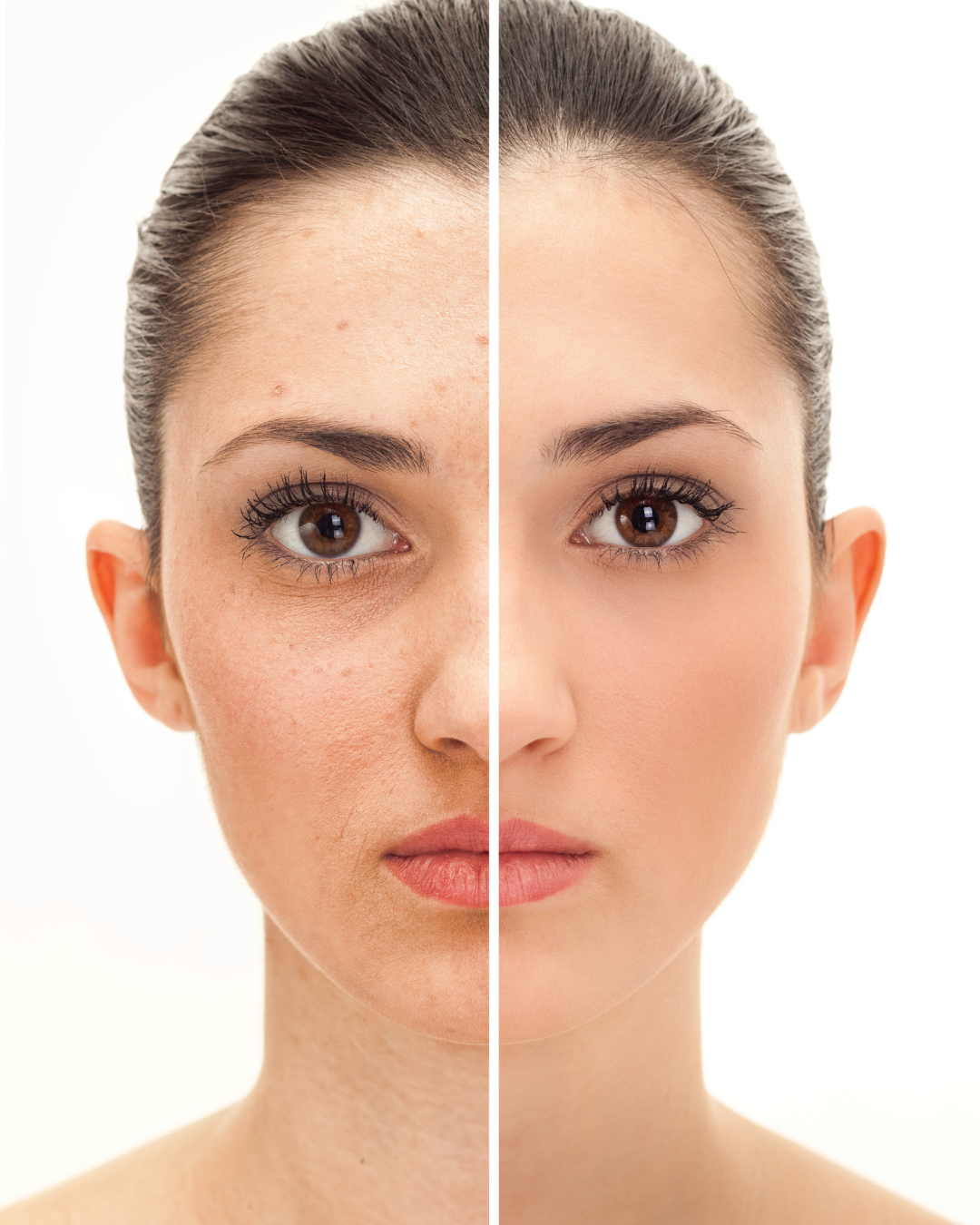 Before and after anti-ageing treatment results at Mayflower Aesthetics