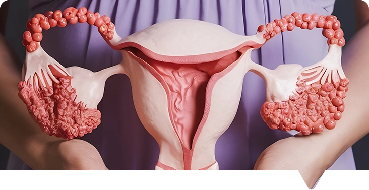 Gynaecology