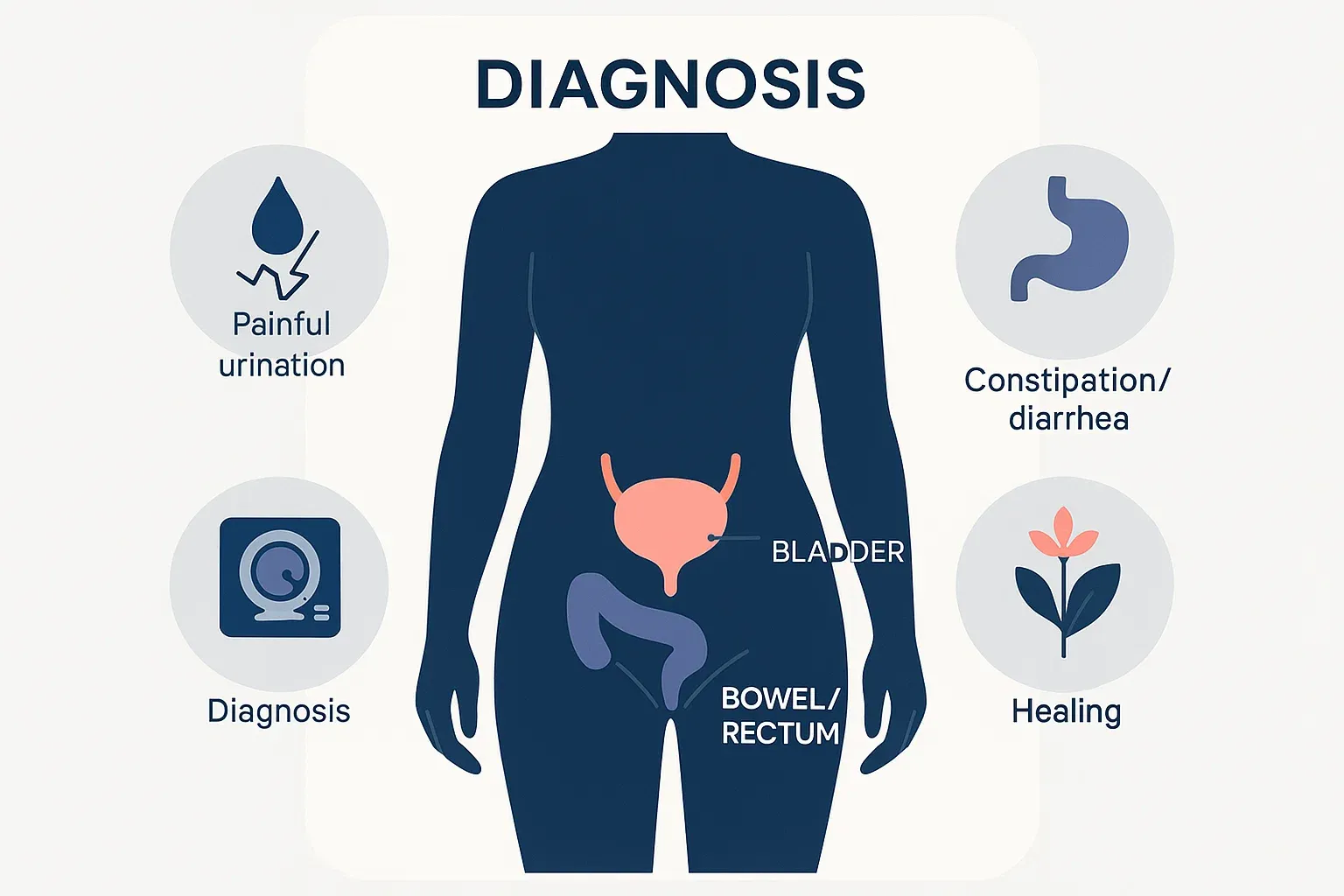 Endometriosis Bladder Symptoms and Bowel Complications Explained