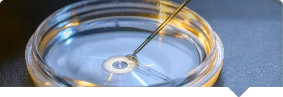 IVF (In Vitro Fertilisation)