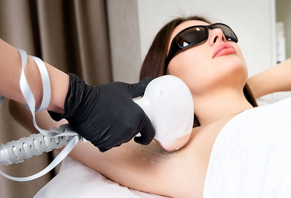 Laser Hair Reduction in Ahmedabad, smooth hair-free skin