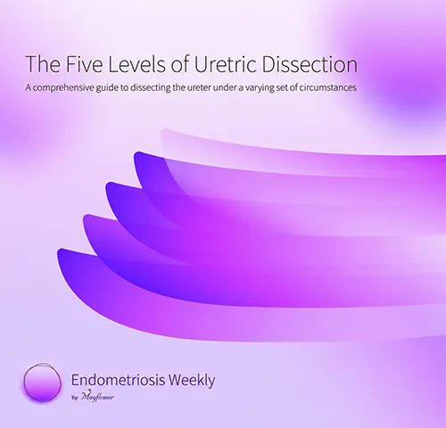 Ureteric Dissection for Endometriosis